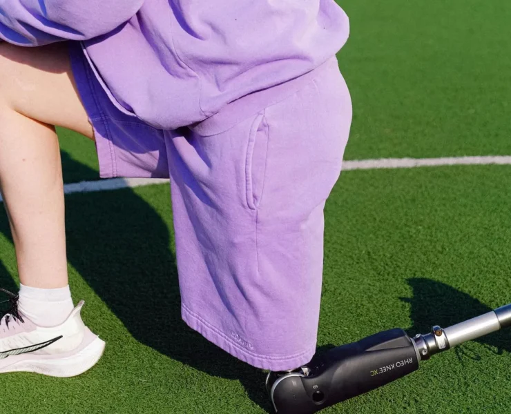 amputee athlete stretching